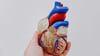 What Is Interventional Cardiology?